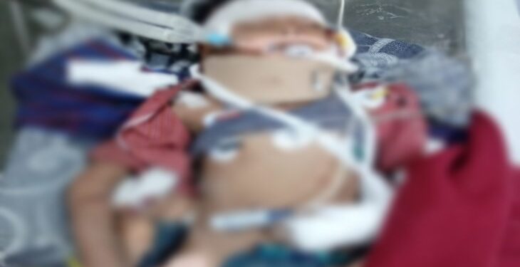 Kanker Road Accident: 7 school children died first… 8th was undergoing treatment in Raipur Mekahara… Breathing stopped this morning