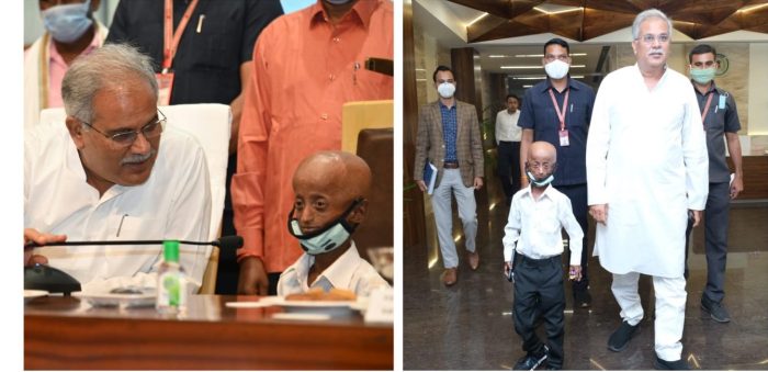 One Day CL Sudden Death: One day Collector Shailendra Dhruv was no more, suffering from Progeria disease, Bhupesh Baghel expressed grief by tweeting