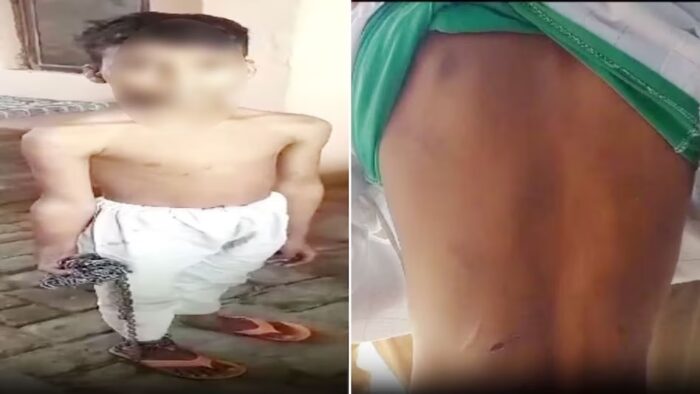 Child Abuse: Picture of barbarity…! Maulana and uncle tied 8 year old child in chains and beat him…Video Viral