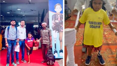 Chirayu Yojana: Life is improving with Chirayu Yojana, little Laxmi has started walking with the help of artificial legs