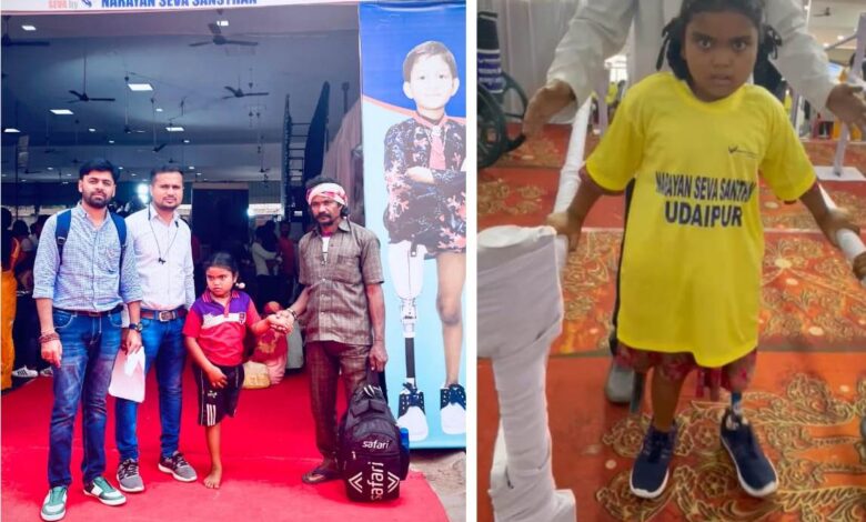 Chirayu Yojana: Life is improving with Chirayu Yojana, little Laxmi has started walking with the help of artificial legs