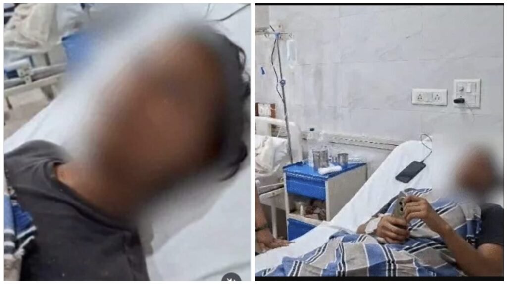 Shocking : चौंकाने वाली खबर…! UPSC की तैयारी कर रहे छात्र ने खुद काटा अपना प्राइवेट पार्ट…गूगल और यूट्यूब से ली ‘सर्जरी’ की जानकारी