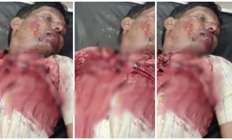 Soldier opened fire: Amidst CM's visit to Korba, a soldier opened fire on his wife and father-in-law...one dead and the other critical