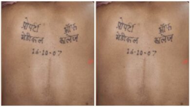Property of Medical College: A tattoo on the back reads, "Property of Medical College..." Everyone is surprised to learn the reason.