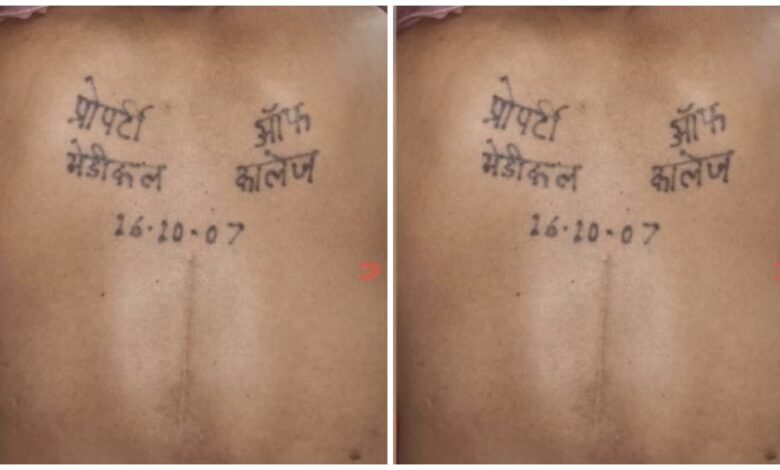 Property of Medical College: A tattoo on the back reads, "Property of Medical College..." Everyone is surprised to learn the reason.