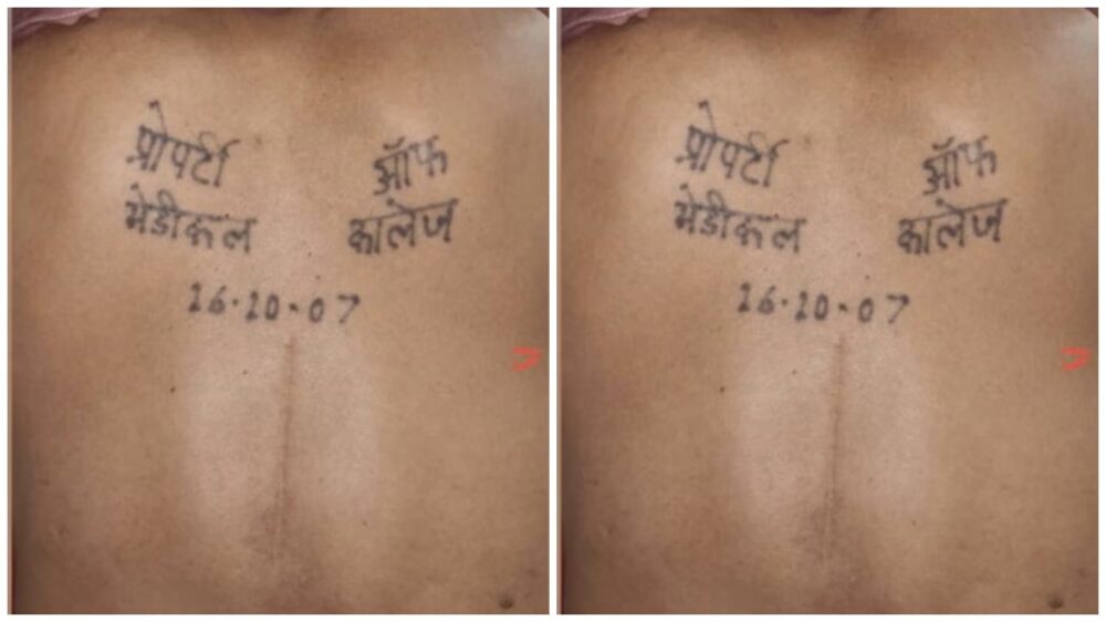 Property of Medical College: A tattoo on the back reads, "Property of Medical College..." Everyone is surprised to learn the reason.