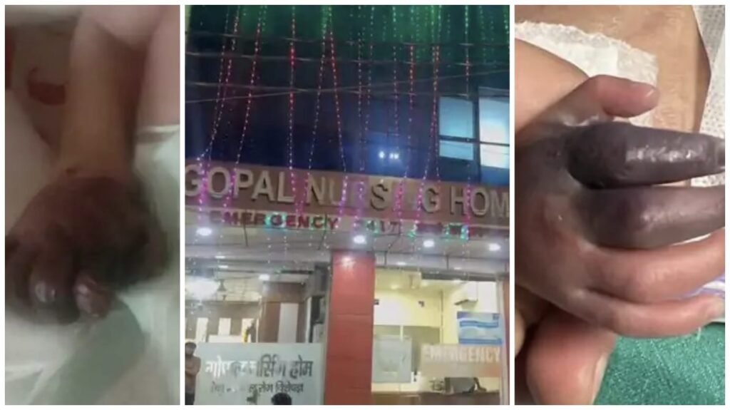 Nursing Homes : निजी हॉस्पिटल में लापरवाही की हद…! नवजात को लगा दिया गलत तरीके से इंजेक्शन…संक्रमित होने पर हाथ काटने की नौबत…यहां देखें