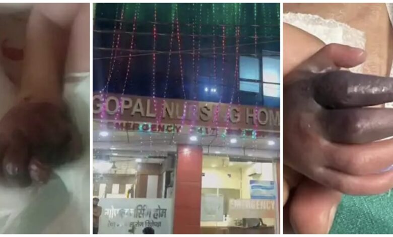 Nursing Homes: Negligence at a private hospital is rampant! A newborn was given the wrong injection...the infection led to the arm being amputated...see here.
