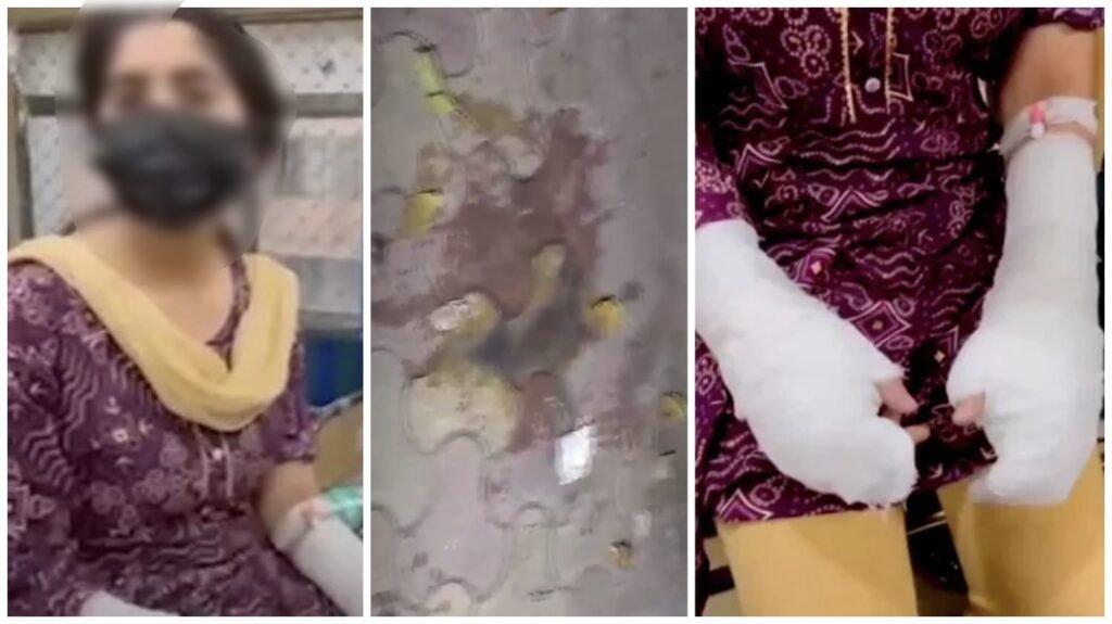 Fake Acid Attack : पिता और बेटी मिलकर रची खतरनाक साजिश…! अपने हाथों पर ‘टॉयलेट एसिड’ डालकर खुद को बताया Victim…दोनों हाथों में बैंडेज बांधकर बटोरी सिम्पथी…खौफनाक कबूलनामा यहां पढ़ें