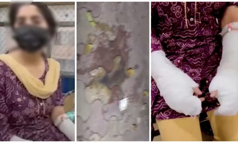 Fake Acid Attack: Father and daughter hatch a dangerous conspiracy...! Poured toilet acid on their hands and declared themselves victims... Bandaged both hands to garner sympathy... Read the chilling confession here.