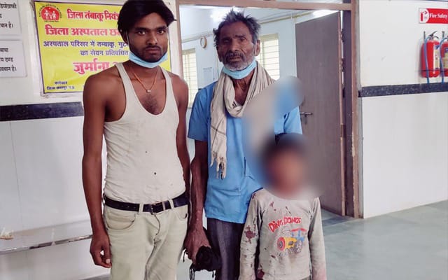 Cornea Damage: Sad news amidst Diwali festivities! A firecracker exploded in a child's hand, completely damaging his cornea and losing his eyesight. See here.