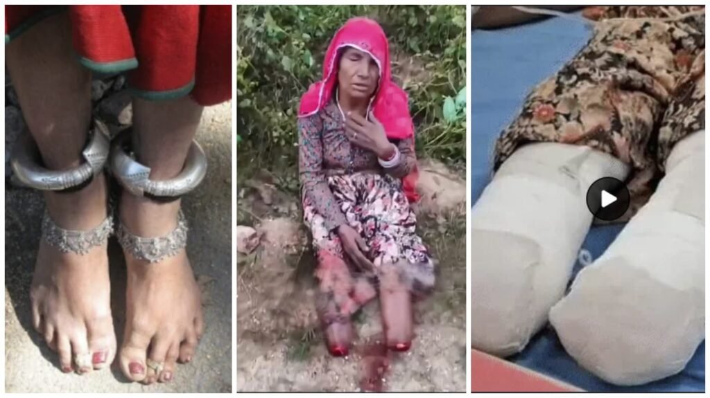 Poignancy : दिल दहला देने वाली घटना…! महिला के पैरों के डेढ़ किलो वजनी चांदी के कड़े लूटने ‘चोर’ ने काट दिए दोनों पंजे…कमजोर दिलवाले ना देखें ये VIDEO