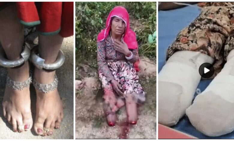 Poignancy: A heartbreaking incident! A thief cut off both a woman's toes to steal her 1.5 kg silver anklets. The faint-hearted shouldn't watch this video.