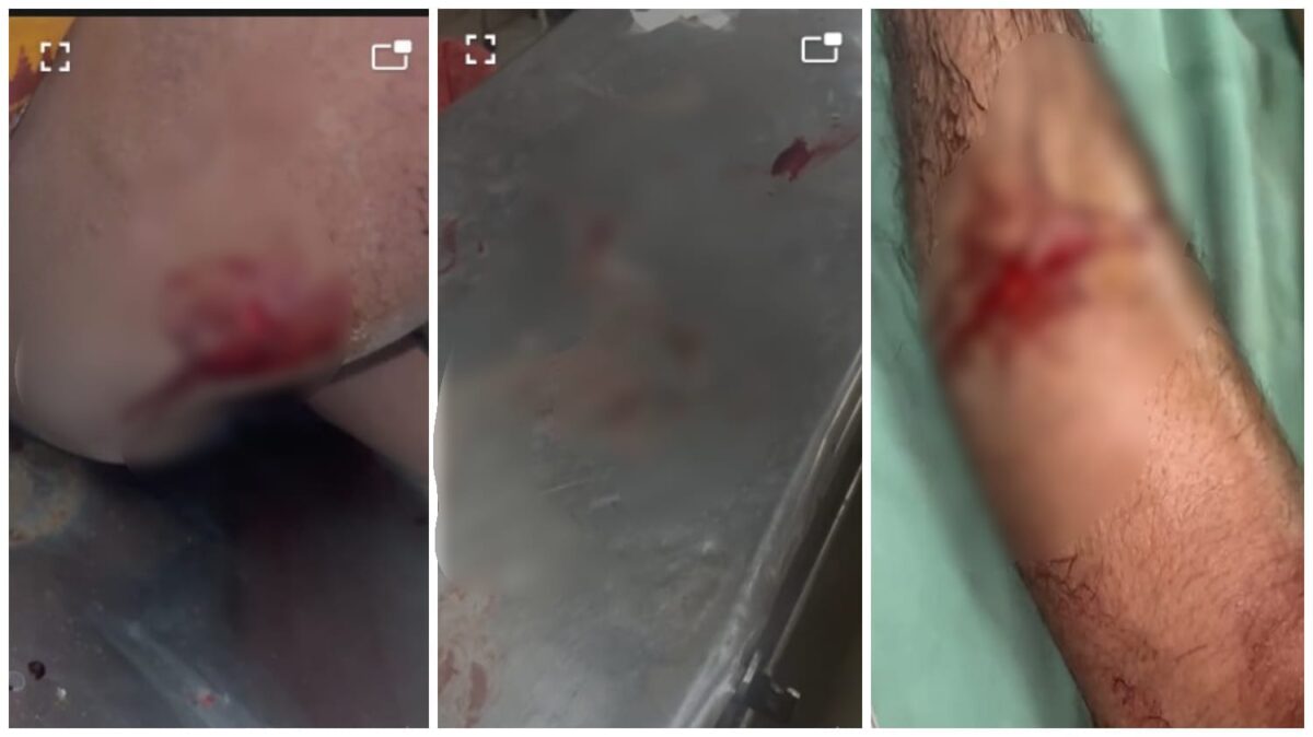 Molestation of a Girl: A knife attack in Raipur amid high alert! A young woman was molested... When her brother tried to stop her, she was attacked with a knife... Watch the video here.