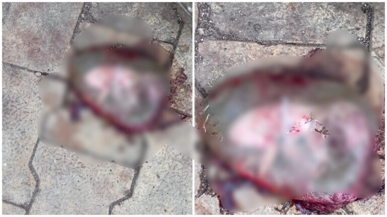 Dead Body of a Newborn: Big news from Raipur! The body of a newborn was found wrapped in polythene near a dustbin outside Mekara Hospital. Watch the video here.