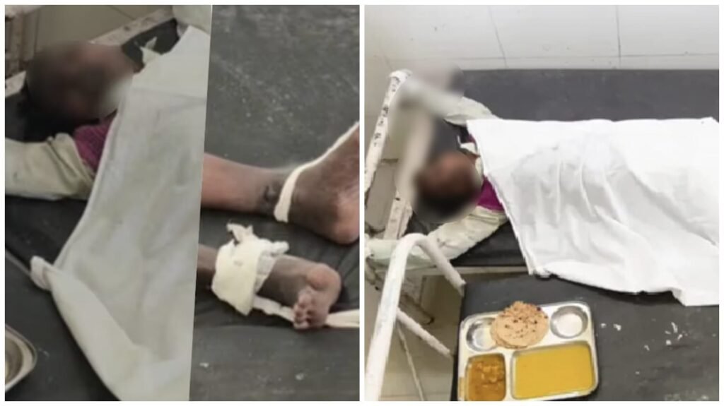 Hospital : लापरवाही से मरीज की दर्दनाक मौत…! हाई शुगर मरीज को गलत वार्ड में रखा…हाथ-पैर बंधे होने से नहीं खा पाए खाना…तोड़ा दम…सामने आया ये Video