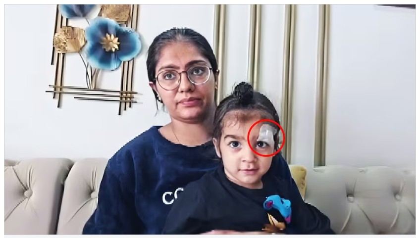 Doctor Negligence: A shocking case of doctor negligence! Instead of stitching a child's wound, he applied Fevicol to it... After much struggle, the adhesive was removed at another hospital.
