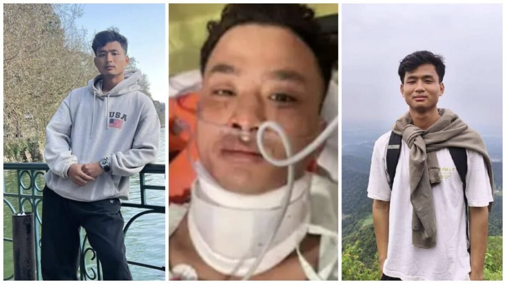 Racial Attack : दुखद…! नस्लीय टिप्पणी के बाद आदिवासी छात्र की दर्दनाक हत्या…किराना सामान खरीदने गए 2 भाइयों को पेट में मारा चाकू