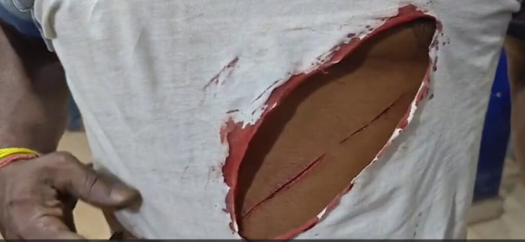 Rowdy Girls : दुर्ग शहर से बड़ी खबर…! सिद्धार्थ नगर में रातभर हंगामा…उपद्रवी लड़कियों ने ब्लेड मारकर कई लोगों को किया घायल…यहां देखें बैक टू बैक Video