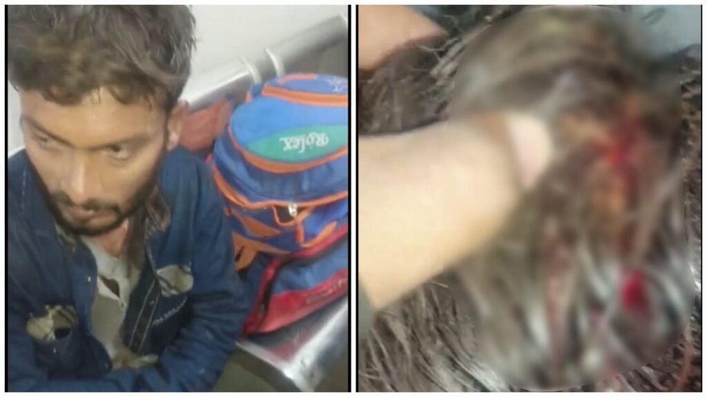 Loot at Railway Station : बिग ब्रेकिंग…! रायपुर रेलवे स्टेशन पर युवक से लूट…सिर में चाकू से हमला…युवक की हालत गंभीर…यहां देखें VIDEO