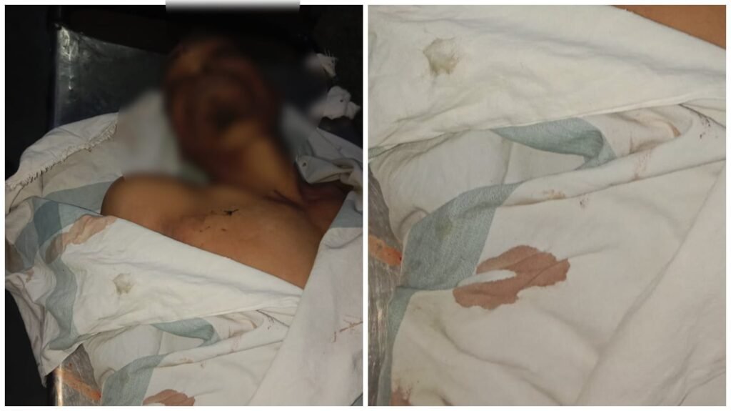 Murder in Samta Colony : बिग ब्रेकिंग…! रायपुर में कमिश्नरेट प्रणाली लागू होने के बाद पहली वारदात…समता कॉलोनी में युवक की चाकू मारकर हत्या