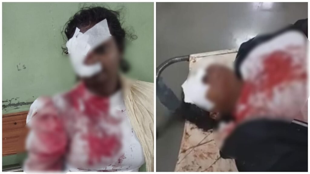 Married Woman Murder : रायपुर ब्रेकिंग…! बियर बार में महिला की हत्या…बॉटल से किया था ताबड़तोड़ वार…आरोपी फरार…यहां देखें