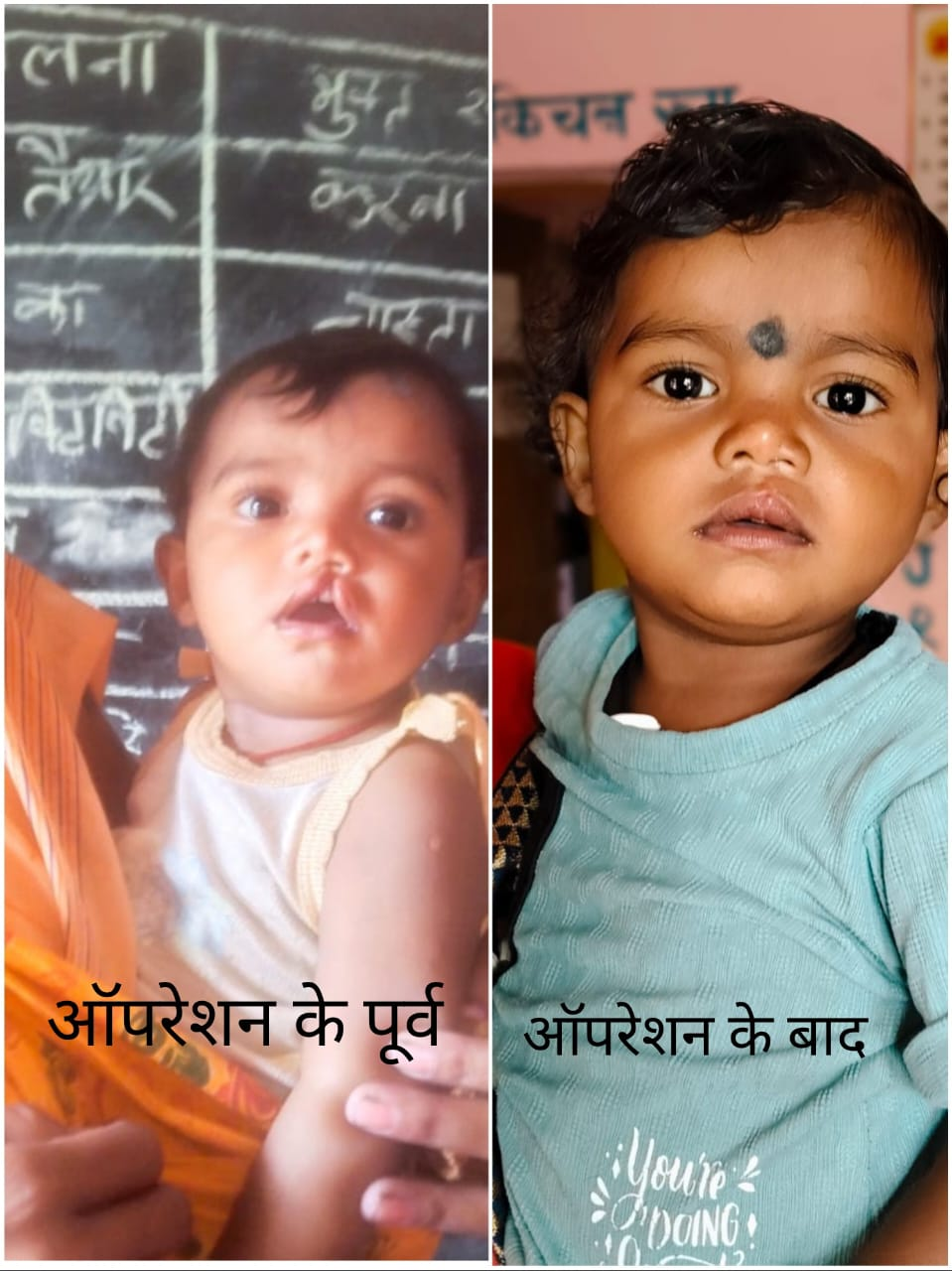 Chirayu Yojana : शासन की योजना से दूर हुई बेटी के भविष्य की चिंता, चिरायु दल ने लौटाई मासूम रंजना की मुस्कान