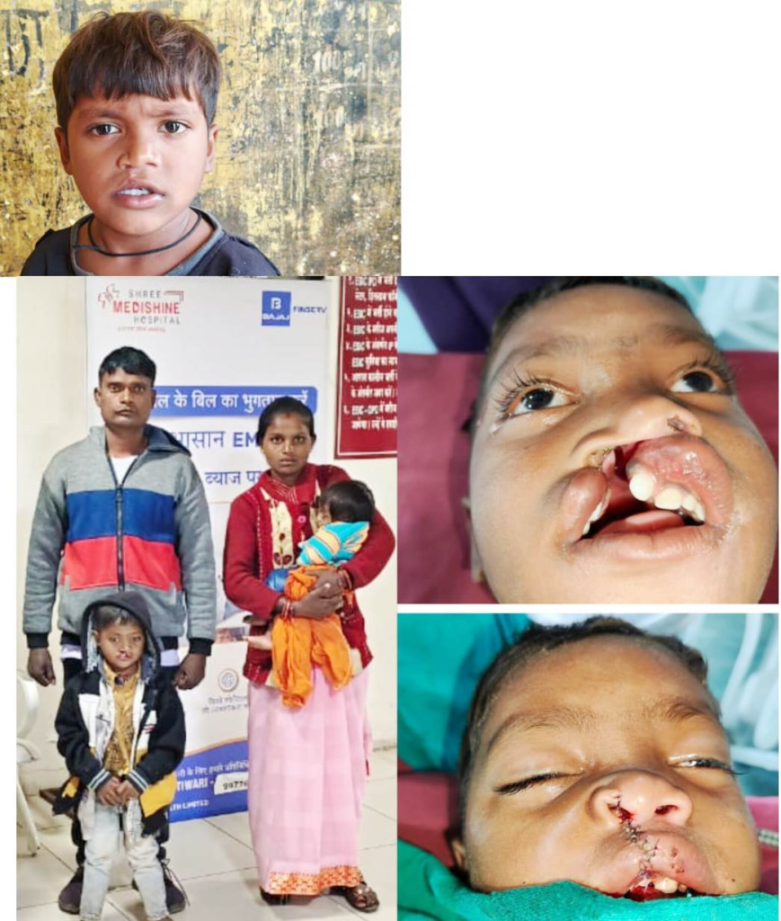 Bastar के वनांचल से खिलखिलाती मुस्कान की नई इबारत लिख रहा नन्हा विक्रम