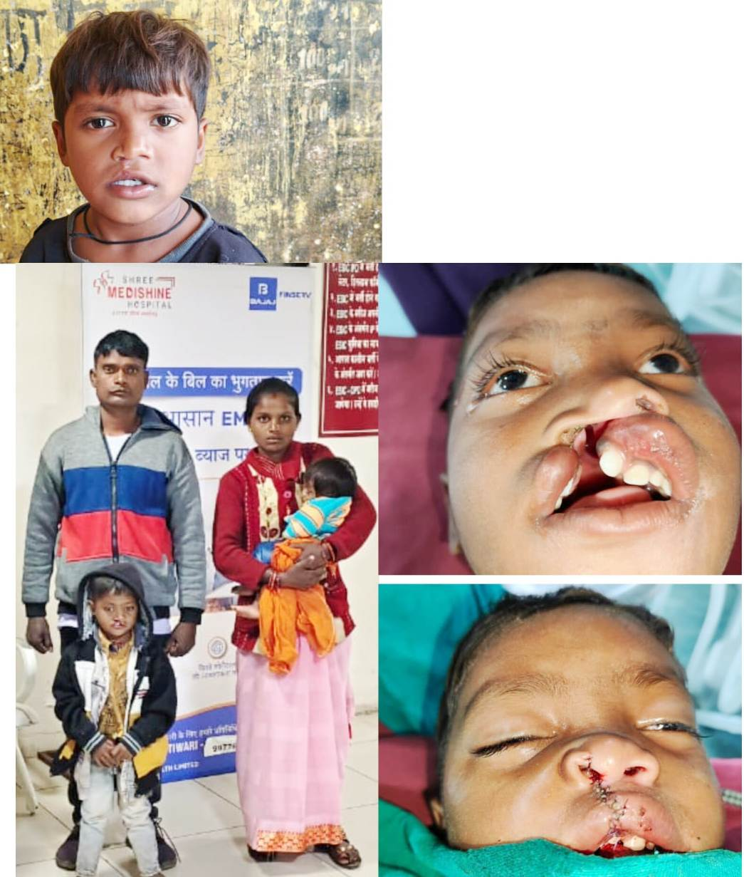 Bastar के वनांचल से खिलखिलाती मुस्कान की नई इबारत लिख रहा नन्हा विक्रम