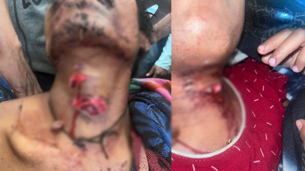 Father Attack : गरियाबंद में दिल दहला देने वाली घटना…! पिता ने 6 साल की बेटी पर किया चाकू से हमला…खुद को भी किया घायल