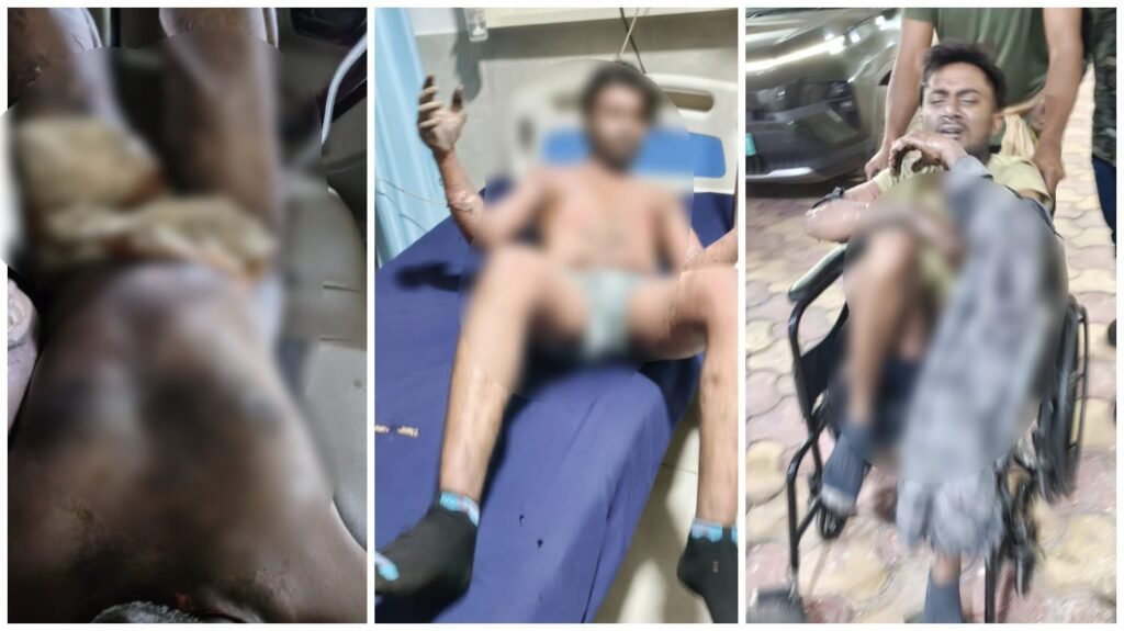 Nova Sponge Iron Plant : बिलासपुर के नोवा स्पंज आयरन प्लांट में बड़ा हादसा…! खौलता लोहा गिरने से 4 मजदूर गंभीर रूप से झुलसे…यहां देखें Video