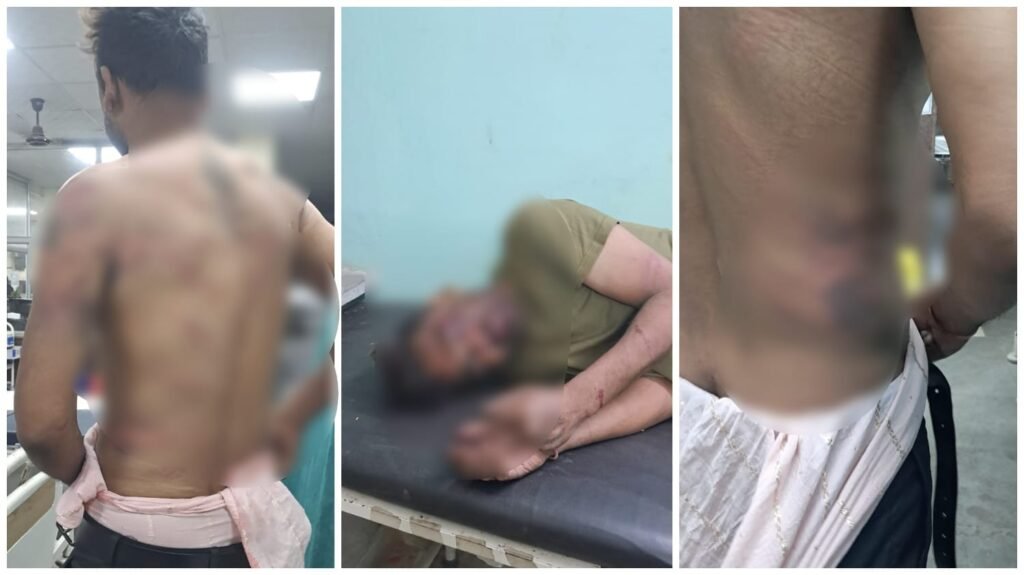 Army Attack : आर्मी जवानों पर जानलेवा हमला…! चखना सेंटर संचालकों ने चाकू-रॉड से किया वार…3 घायल…पुलिस अलर्ट