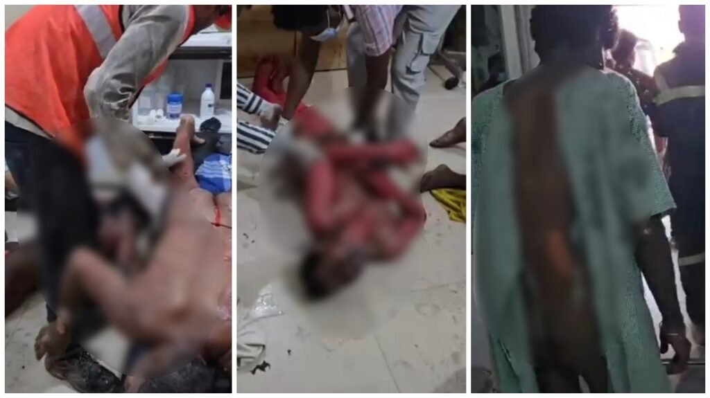 Boiler Blast Update : वेदांता हादसे के बाद प्रशासन एक्शन में…! राहत-बचाव तेज…कलेक्टर-SP मौके पर…मजिस्ट्रियल जांच के आदेश