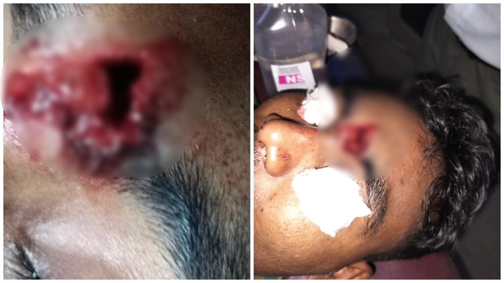 Attack on Sakti Police : बच्ची की मौत के बाद सक्ती में बवाल…! प्रदर्शनकारियों का पुलिस पर हिंसक हमला…बुरी तरह फूटा कॉन्स्टेबल का सिर…3 अरेस्ट