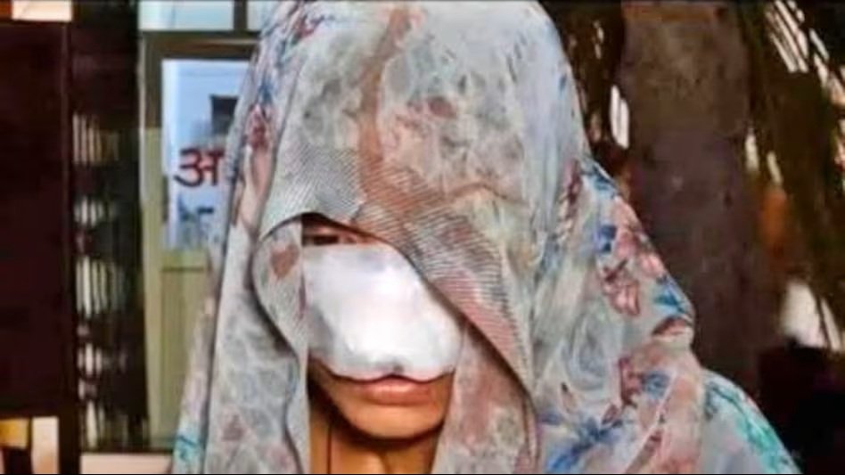 Domestic Violence : घरेलू विवाद बना खूनी खेल…! पति ने पत्नी को बेदम पीटा फिर दांतों से काटा नाक…गाल और चेहरे को भी पहुंचाई चोटें