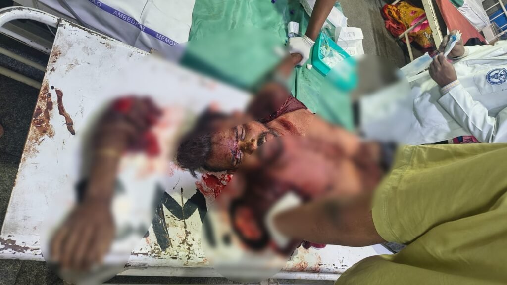 Train Accident : रायपुर में देर रात दर्दनाक ट्रेन हादसा…! ट्रेन की चपेट में आया युवक…शरीर से कटकर अलग हुआ एक हाथ…देर रात तड़पता हुआ मिला