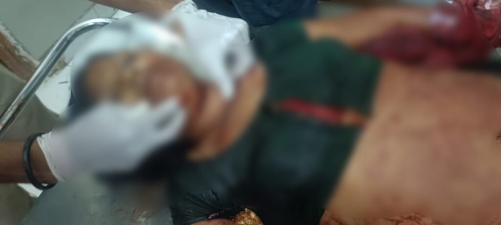 Murder of a Mitanin : गरियाबंद में खूनी हमला…! ब्लेड से गर्दन काट मितानिन की हत्या…बचाने पहुंचे पति-बेटों पर भी ताबड़तोड़ वार…यहां देखें VIDEO