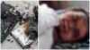 Mobile Battery Explosion: A Tragic Incident Shakes Surajpur! Mobile Battery Explodes While Child Was Playing—Innocent Child Meets a Tragic End; Defective Battery Proves Fatal.