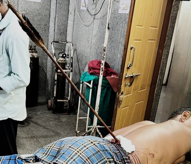 Raipur Ambedkar Hospital : पीठ से पेट तक धंसा था तीर…मेकाहारा के डॉक्टरों ने किया सफल ऑपरेशन…! गंभीर मरीज को मिला नया जीवन
