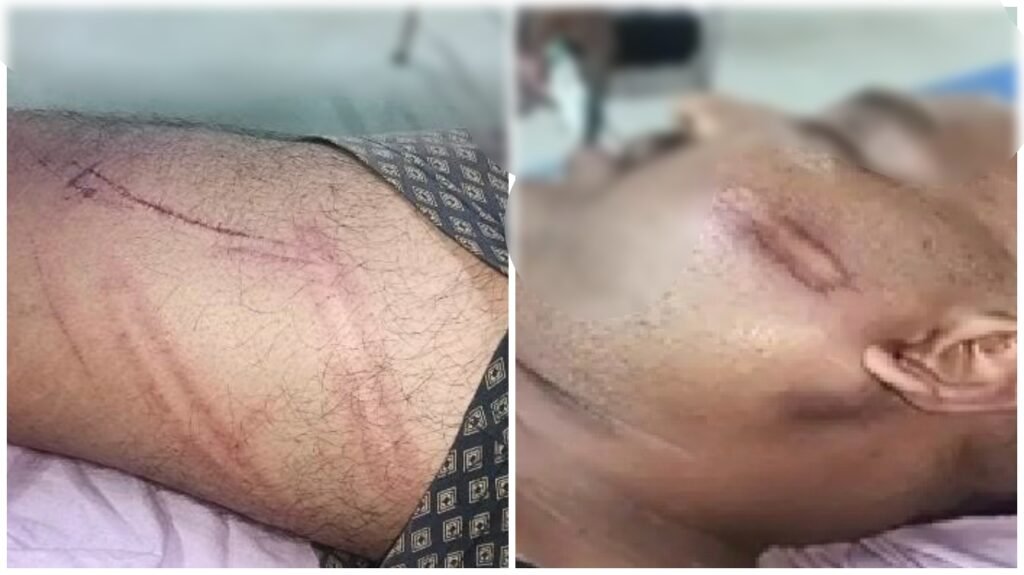 BJP Leader Attack : कोरबा में भाजपा किसान मोर्चा नेता पर जानलेवा हमला…! कार में तोड़फोड़…बेरहमी से पिटाई, ₹60 हजार लूटने का आरोप