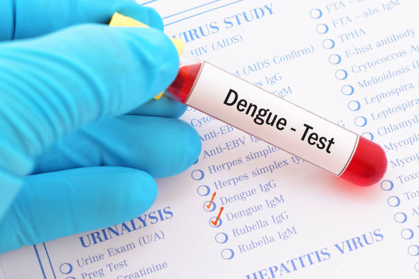 National Vector-Borne Disease Control कार्यक्रम के तहत जिले को डेंगू मुक्त बनाने की दिशा में किए जा रहे प्रभावी पहल, विभाग की अपील, डेंगू के लक्षण दिखाई देने पर तत्काल नजदीकी स्वास्थ्य केंद्र में कराएं जांच