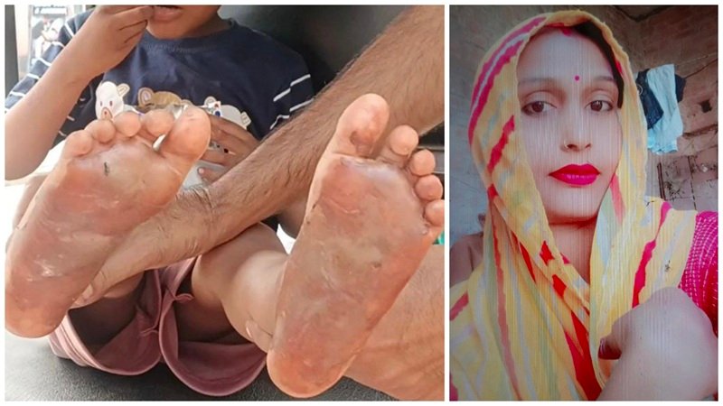 Child Abuse : नशे की तलबगार एक ऐसी मां…! 6 साल के बेटे को 20 रुपये देकर भेजा गुटखा खरीदने…बच्चे ने 5 रुपए में कुछ खाया…भड़की मां गर्म चाकू से दागे तलवे फिर कमरे में बंद कर चली गई Birthday पार्टी