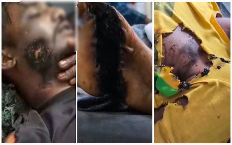 Electrocution Accident: हीरापुर में बड़ा हादसा: गणेश विसर्जन के बाद पंडाल में सो रहे थे 7-8 युवक, अचानक फैला करंट; 4 की मौत, गांव में पसरा मातम देखें VIDEO
